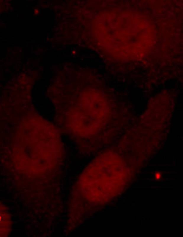 Anti-Phospho-HDAC2 (Ser394) Polyclonal Antibody
