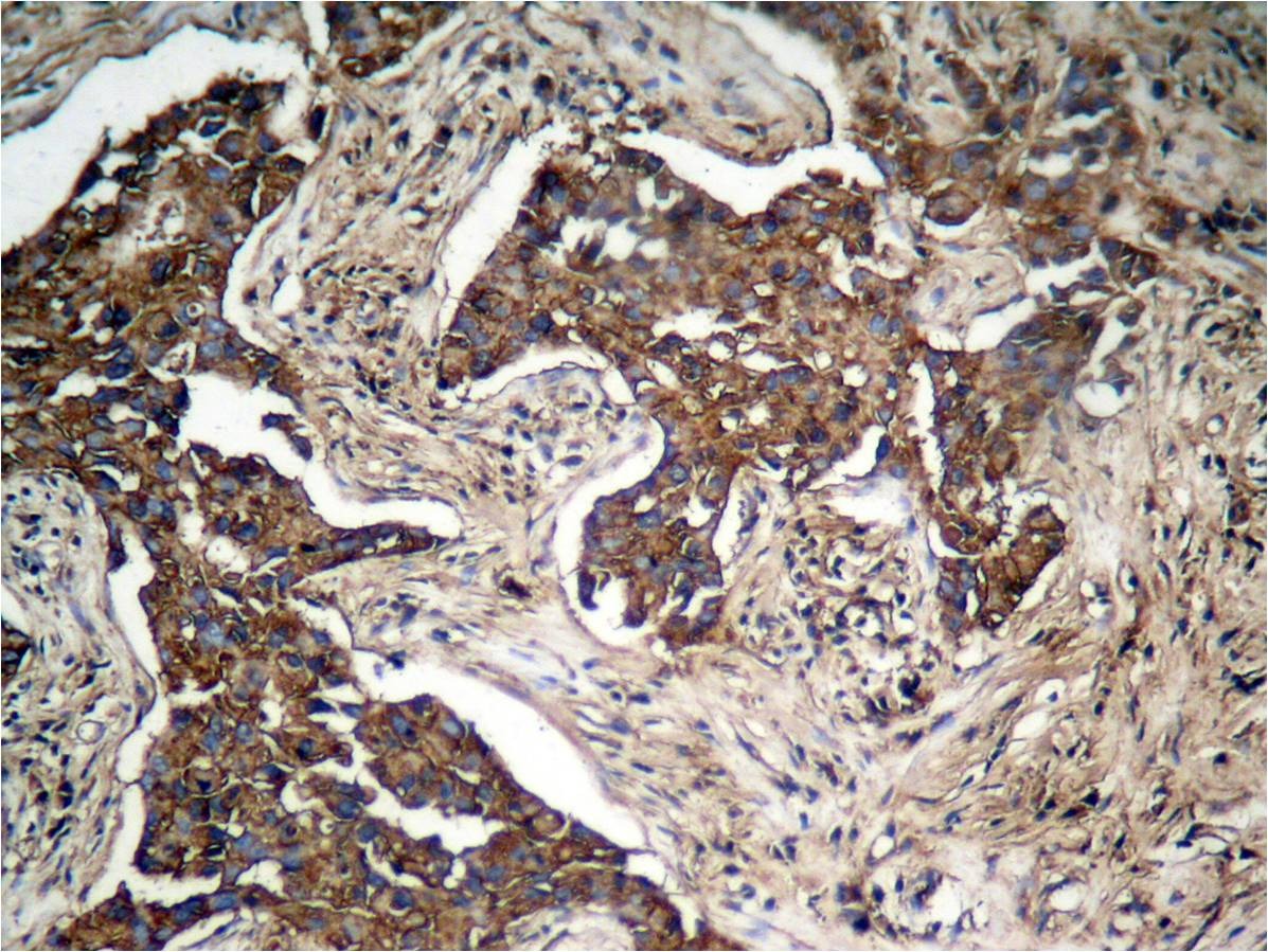 Anti-Phospho-HER2/ERBB2 (Tyr1248) Polyclonal Antibody 2