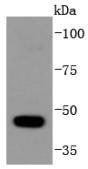 Anti-HDAC10 Antibody (7E996)