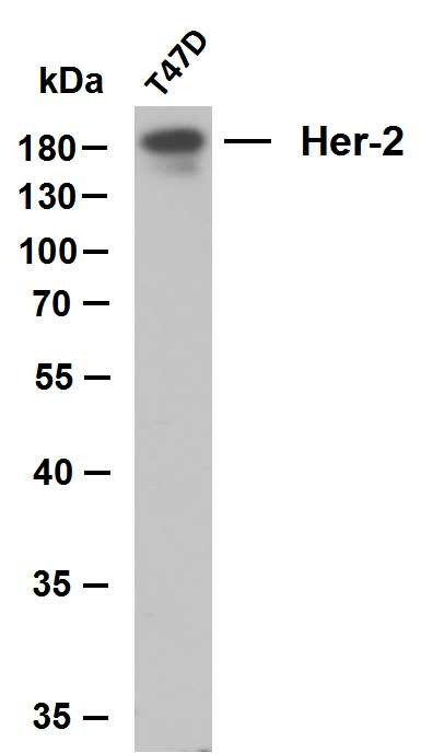 Anti-HER2/ERBB2 Antibody (8K444)