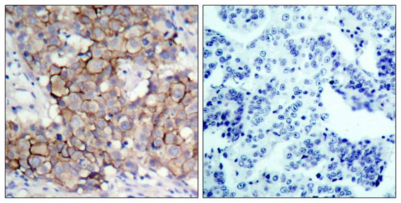 Anti-Phospho-HER2/ERBB2 (Tyr877) Polyclonal Antibody 2
