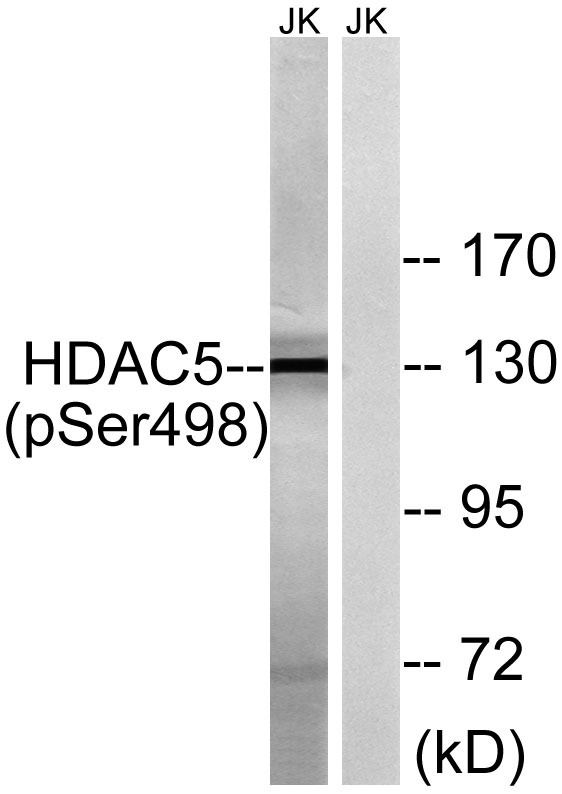 Anti-Phospho-HDAC5 (Ser498) Polyclonal Antibody