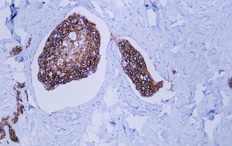 Anti-HER2/ERBB2 Antibody (8K444)