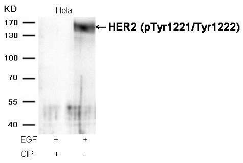 Anti-Phospho-HER2/ERBB2 (Tyr1221, 1222) Polyclonal Antibody 3