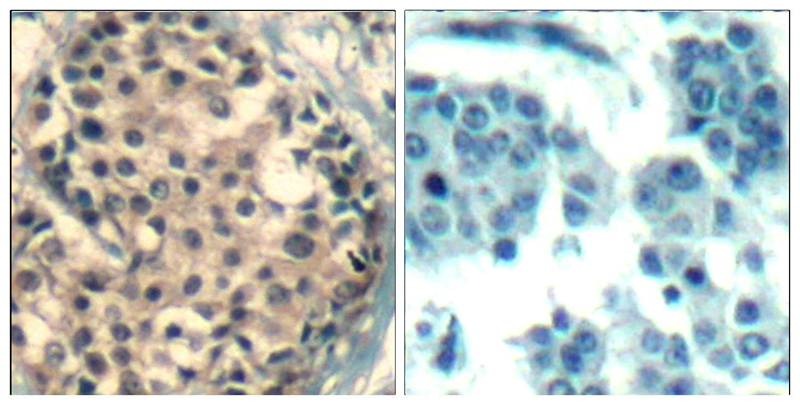 Anti-Phospho-HDAC4/5/9 (Ser246/259/220) Polyclonal Antibody