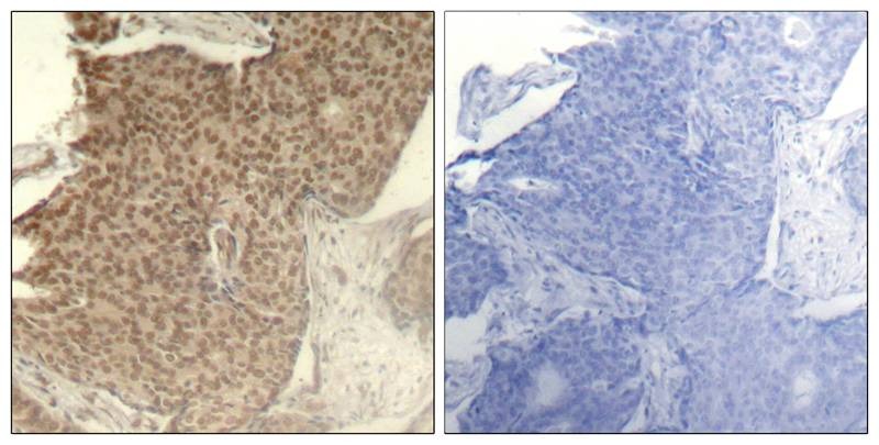 Anti-Phospho-HDAC2 (Ser394) Polyclonal Antibody