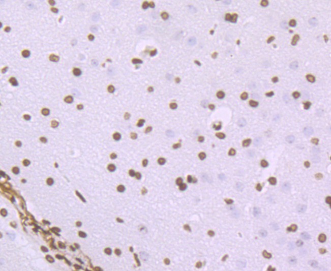 Anti-HIST1H1C Antibody (3S922)