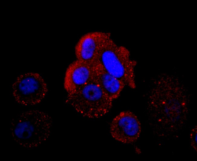 Anti-Hemoglobin subunit gamma-1/HBG1 Antibody (7L271)