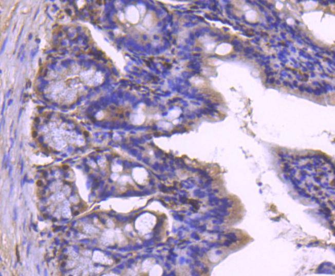Anti-Histone H1.0 Antibody (8A133)