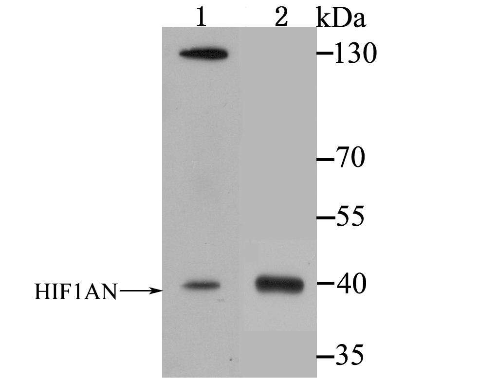 Anti-HIF1AN Antibody (9B616)