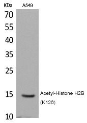 Anti-Acetyl-Histone H2B (Lys126) Polyclonal Antibody