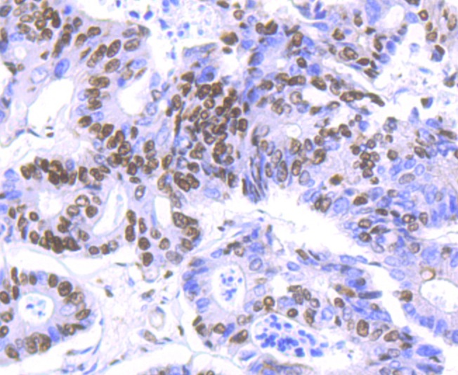 Anti-HDAC9 Antibody (3X420)