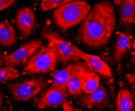 Anti-WFDC2 Antibody (4W741)