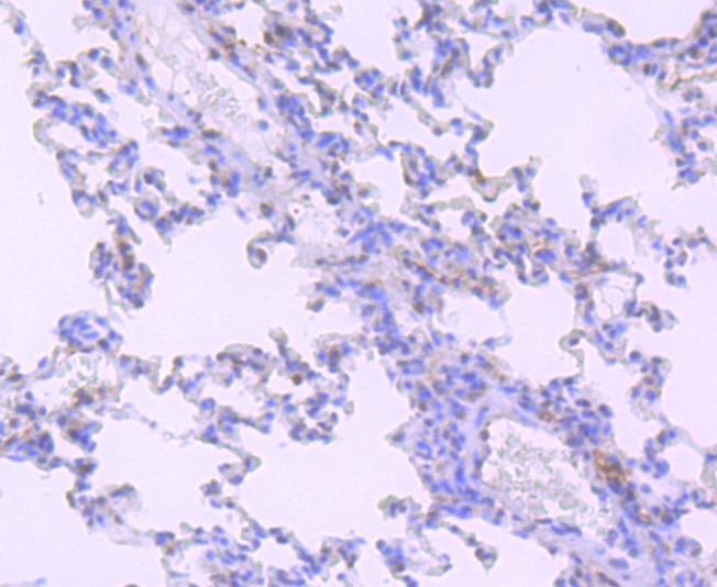 Anti-EPAS1 Antibody (7C2)