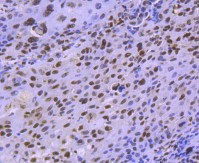 Anti-HDAC8 Antibody (6A120)
