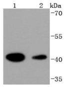 Anti-HDAC8 Antibody (6A120)