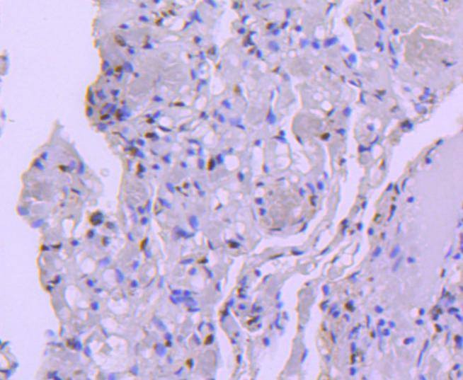 Anti-HDAC8 Antibody (6A120)