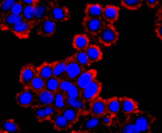 Anti-WFDC2 Antibody (4W741)