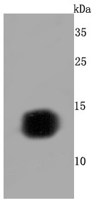 Anti-Hemoglobin subunit gamma-1/HBG1 Antibody (7L271)
