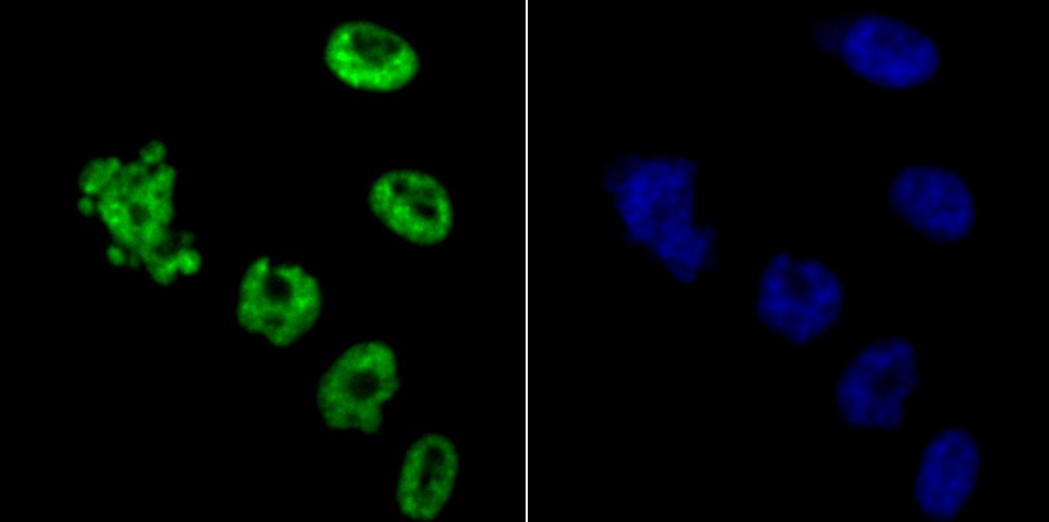 Anti-HDAC9 Antibody (3X420)