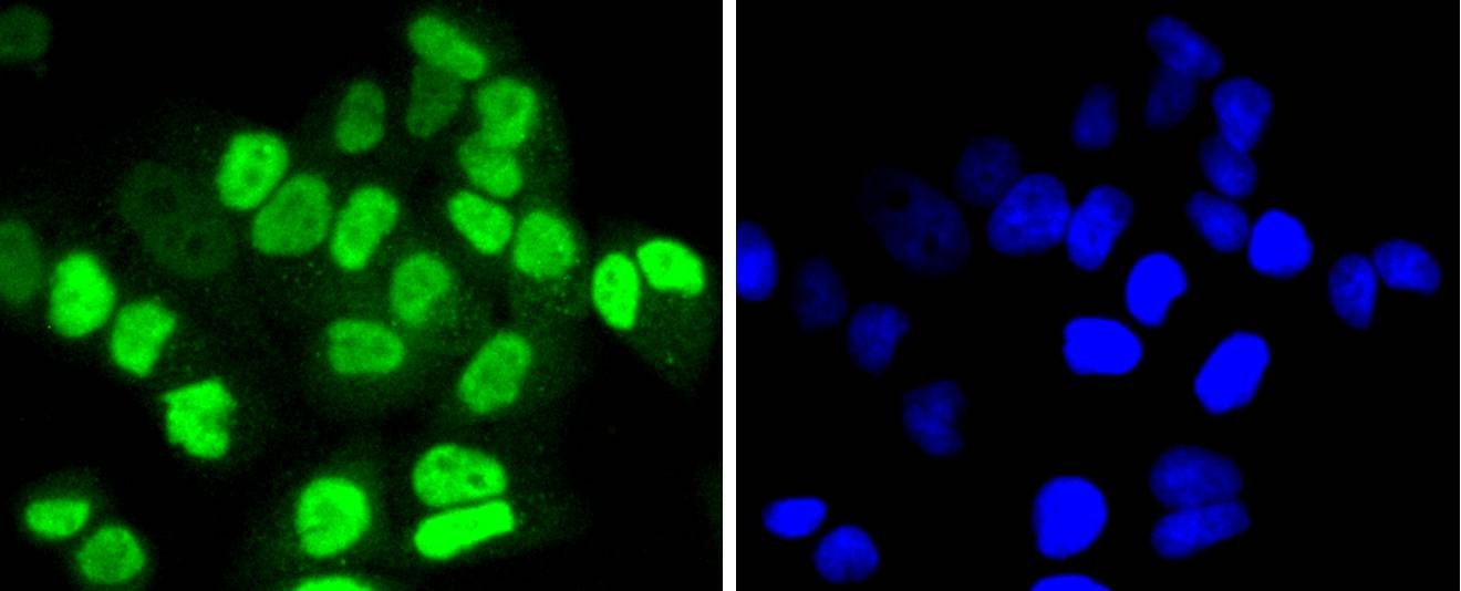 Anti-HDAC8 Antibody (6A120)