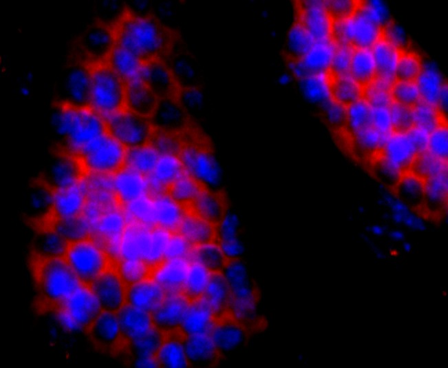 Anti-Hemoglobin subunit gamma-1/HBG1 Antibody (7L271)