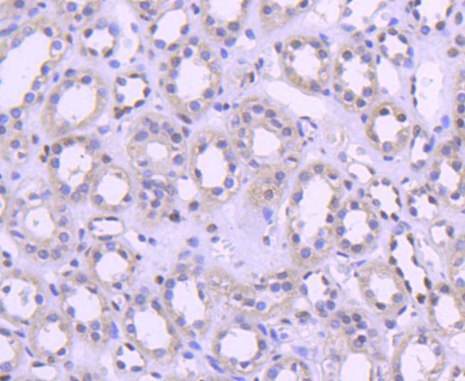 Anti-Histone H1.0 Antibody (8A133)