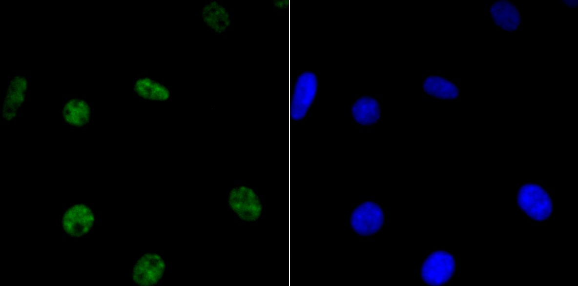 Anti-HDAC9 Antibody (3X420)