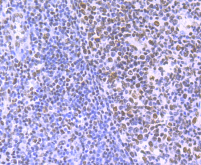 Anti-HDAC9 Antibody (3X420)