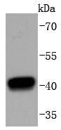 Anti-HDAC8 Antibody (4E776)