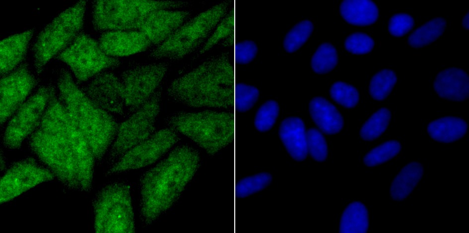 Anti-HIF1AN Antibody (9B616)