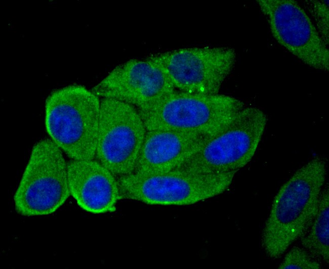 Anti-Hemopexin Antibody (2V675)