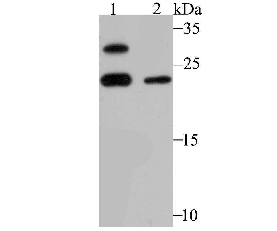Anti-GSTP1 Antibody (9S908)