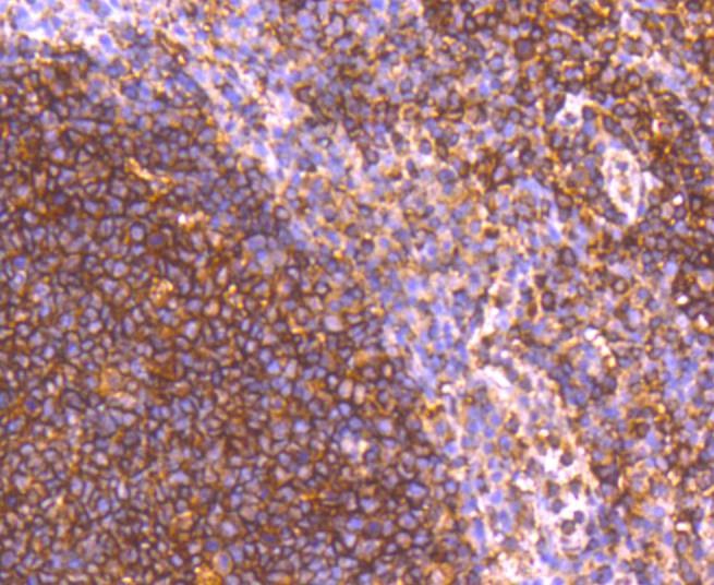 Anti-GRK2 Antibody (8P72)