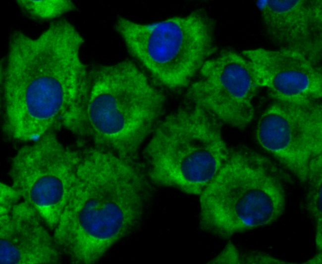 Anti-GHR Antibody (1M753)