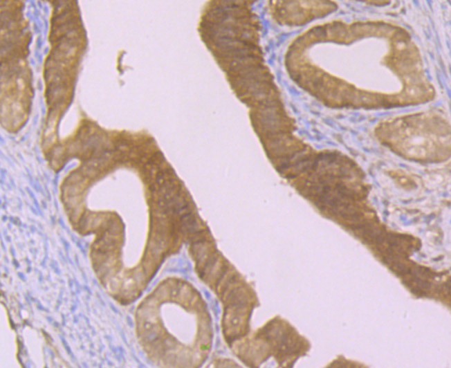 Anti-GSTP1 Antibody (9S908)
