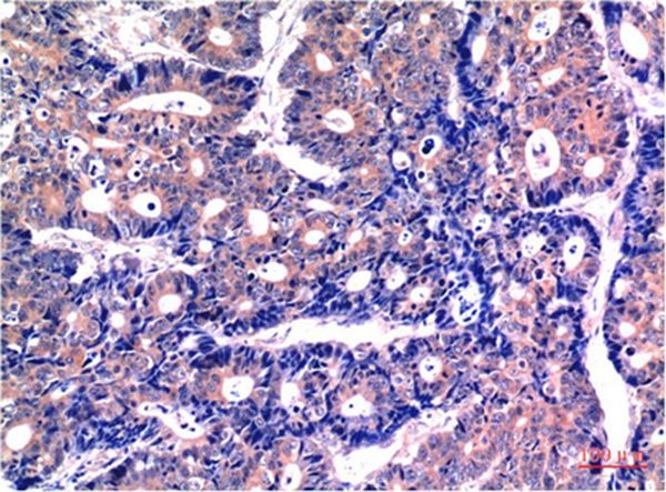 Anti-GSK3B Antibody (7F258)
