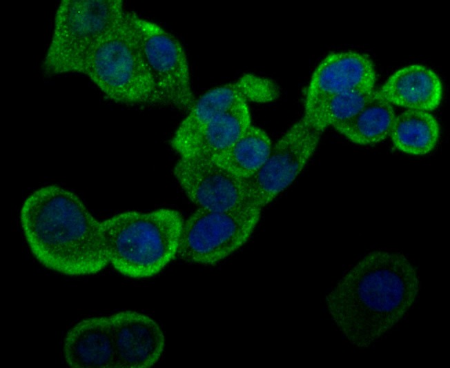 Anti-GSTP1 Antibody (9S908)