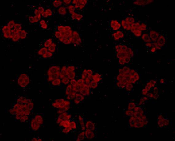 Anti-HSPA5 Antibody (2X960)