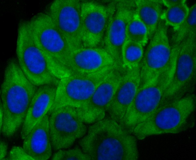 Anti-GHR Antibody (1M753)
