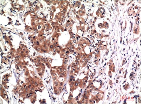 Anti-GSK3B Antibody (7F258)