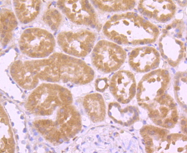 Anti-GPX1 Antibody (4U620)