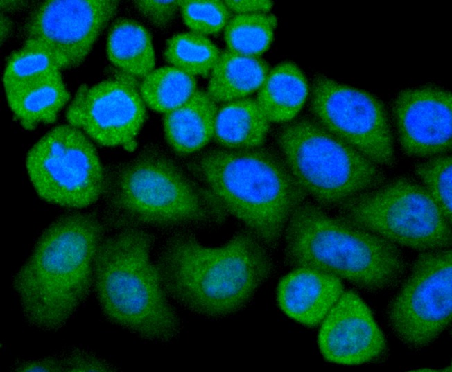 Anti-GPX1 Antibody (4U620)