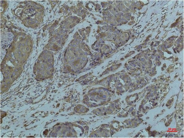 Anti-HSPA5 Antibody (3N226)