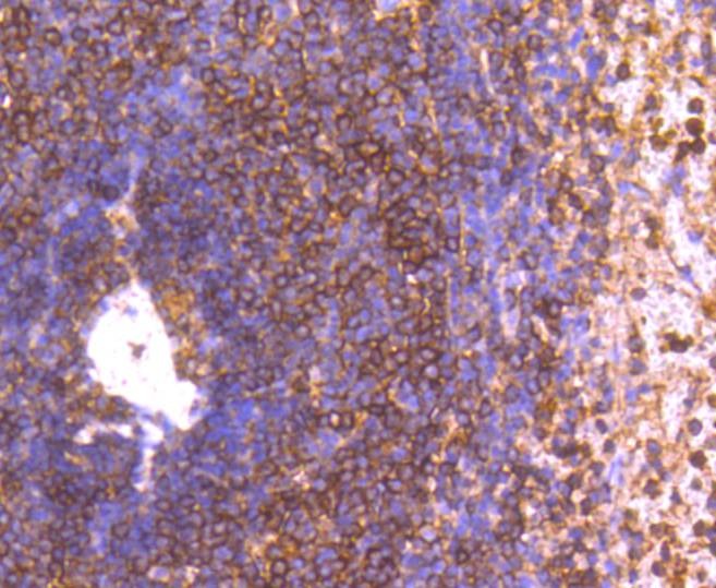 Anti-GRK2 Antibody (8P72)