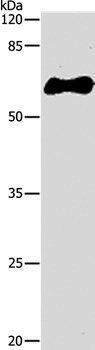 Anti-GST Tag Polyclonal Antibody 2