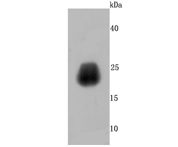 Anti-Growth Hormone Antibody (1Z775)