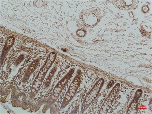 Anti-HSPA5 Antibody (2Y907)