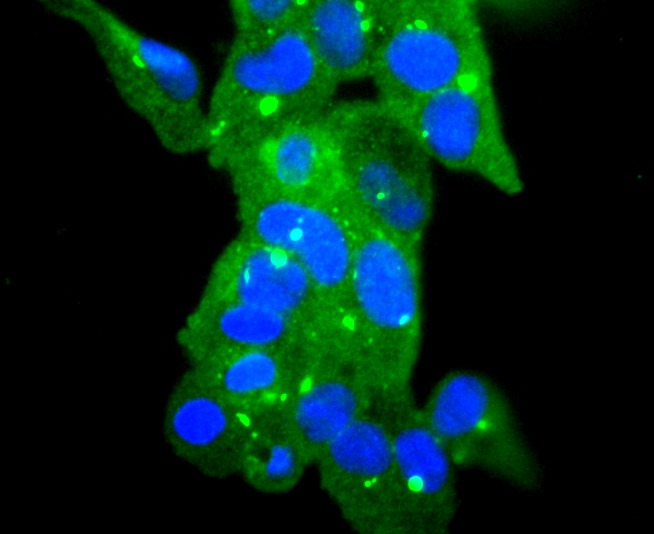 Anti-GPX1 Antibody (4U620)