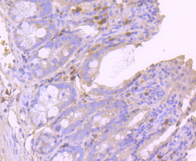 Anti-GPX1 Antibody (4U620)